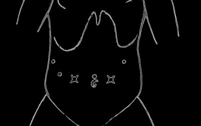 Tecnica dell’anastomosi pancreatico-digiunale per via laparoscopica