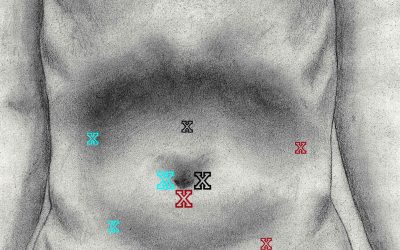 Accessi chirurgici per l’esplorazione laparoscopica del tenue