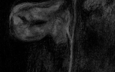 Vi è l’indicazione ad effettuare una colecistectomia in corso di pancreatite acuta?